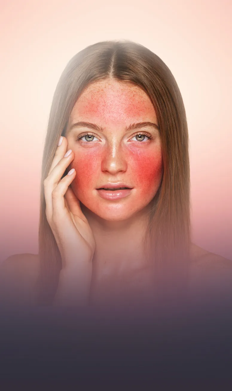 PRP Facial Rejuvenation treatment at Toronto medical spa